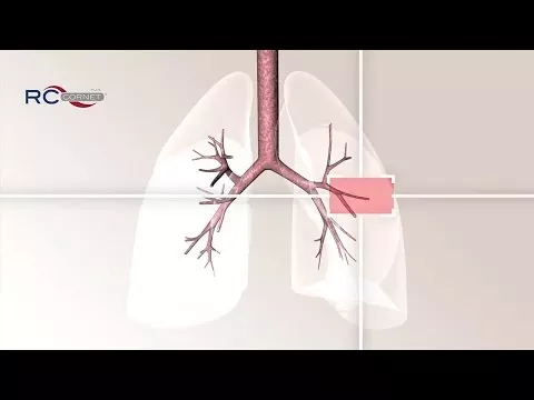 Video o izdelku RC Kornet Plus, 1 kos