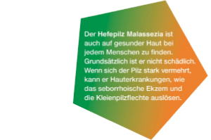 KETOZOLIN 2% šampon, 60 ml