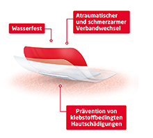 LEUKOMED T plus skin sensitive sterilen 8x10 cm, 5 kosov