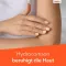 HYDROCORTISON-ratiopharm 0,5-odstotno pršilo, 30 ml