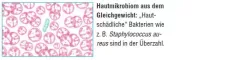 Instructions for use for AKTIVADERM ND Nevrodermatitis kože aktivni probiotiki, 125 g - 2