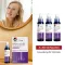 MINOXIDIL DoppelherzPharma 20 mg/ml raztopina za ženske, 3X60 ml